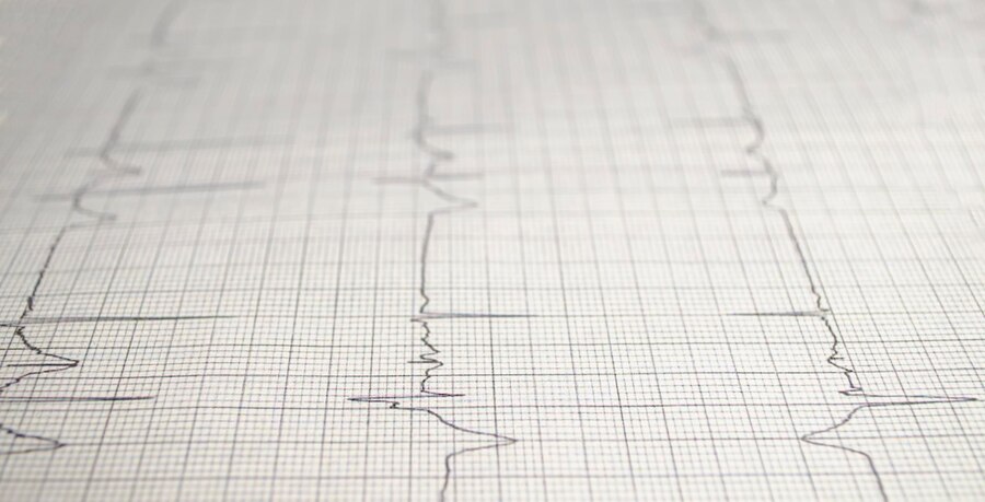 Cardiogram chart