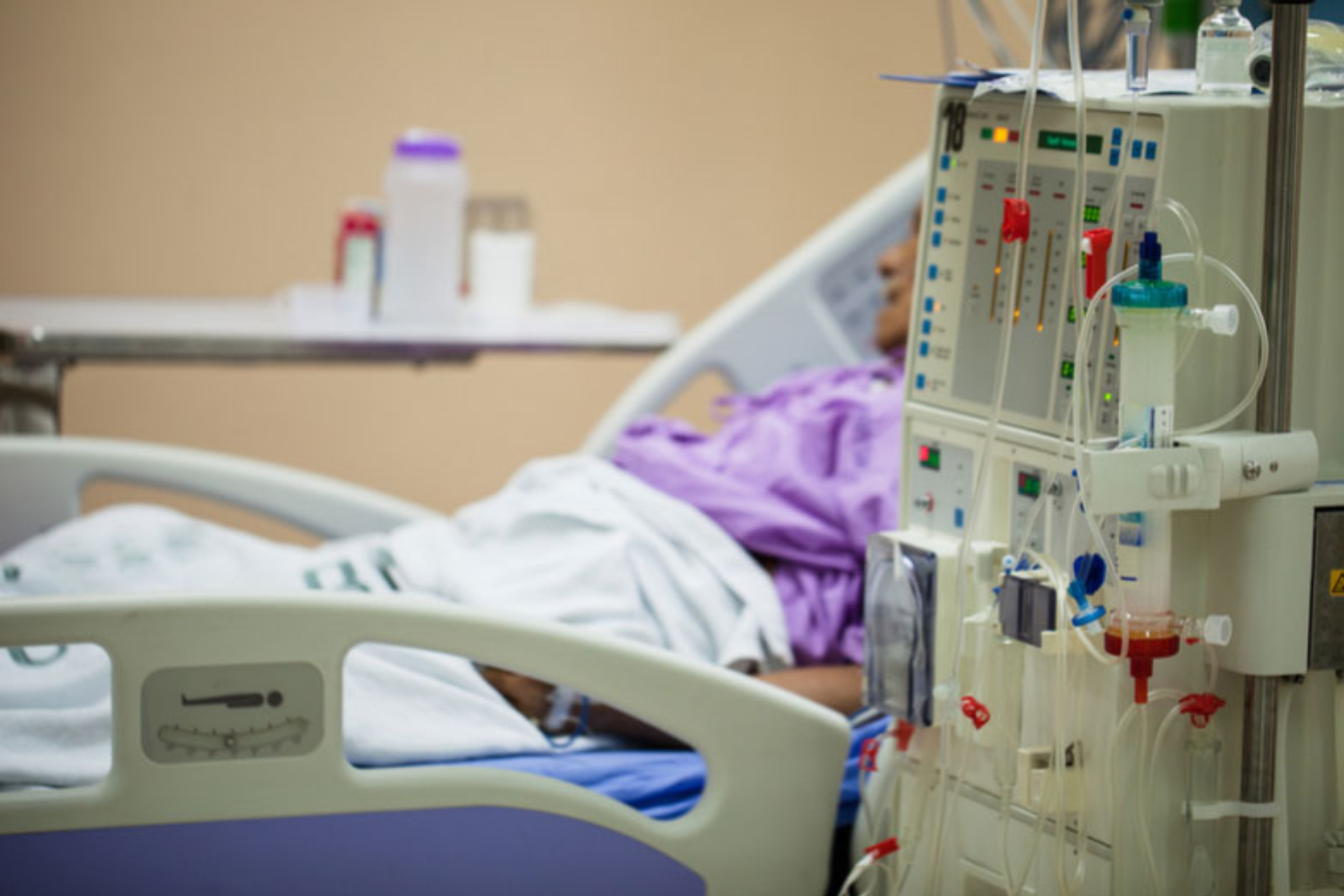 A woman is falling asleep off during her dialysis treatment