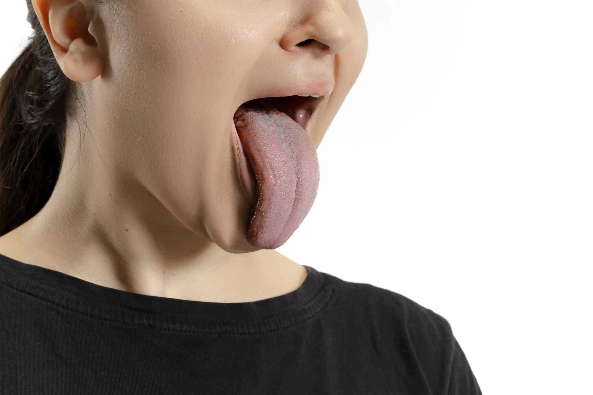 Tongue Signs Of Health Problems – How To Interpret Them For Good Diagnosis