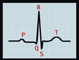 Q Waves - A New Shift In ECG For Heart Problems