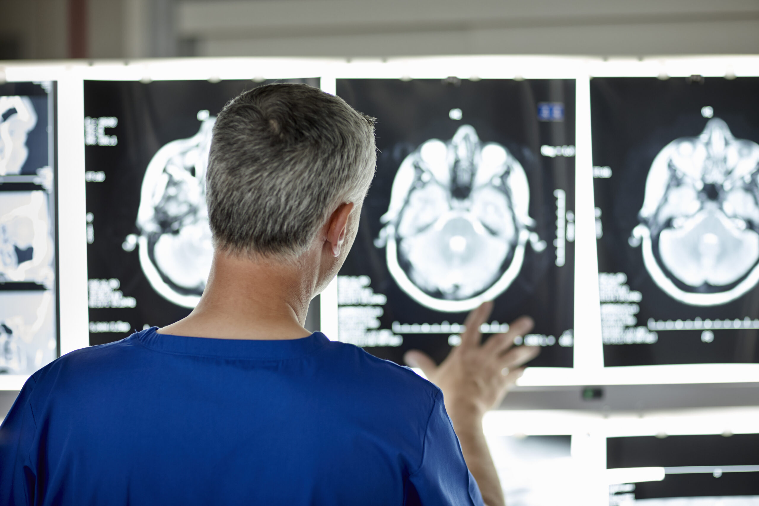 A doctor wearing a blue scrub with one of his hands placed on a screen with x-ray images of a human brain
