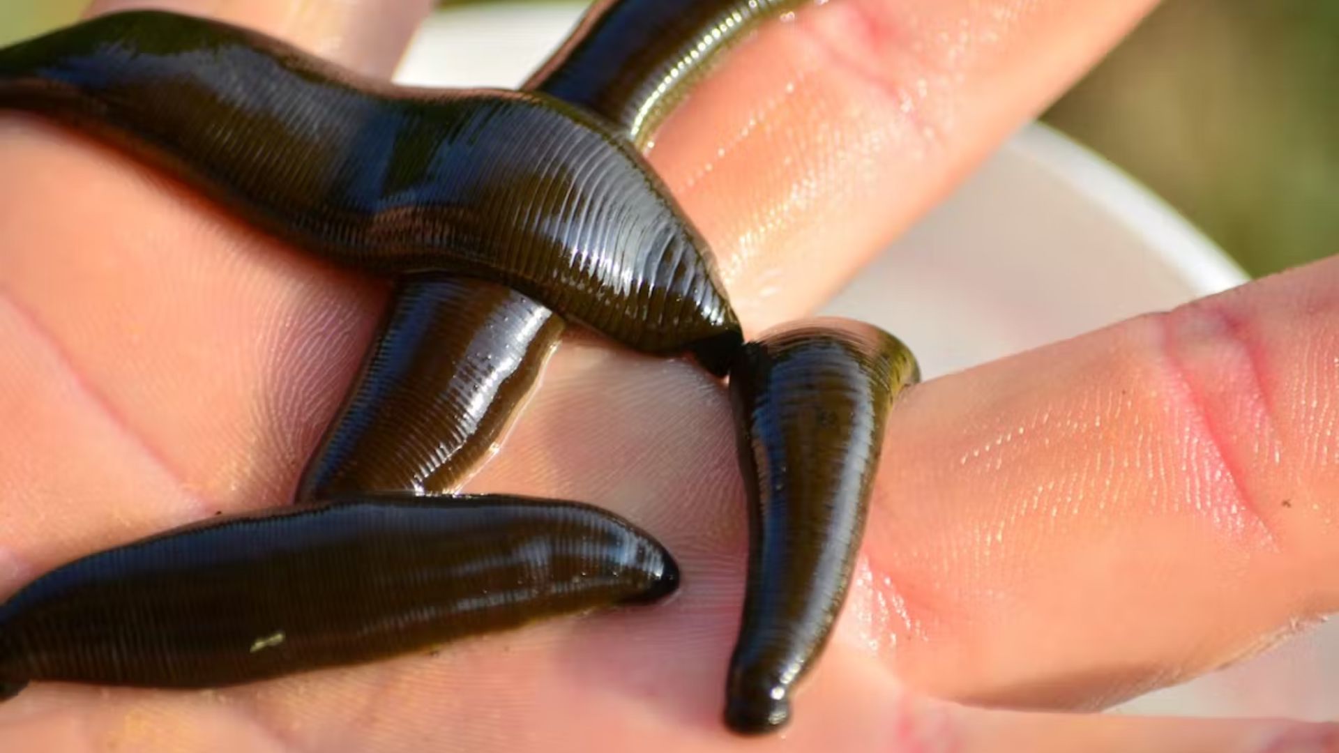 Leeches on a Person's Hand