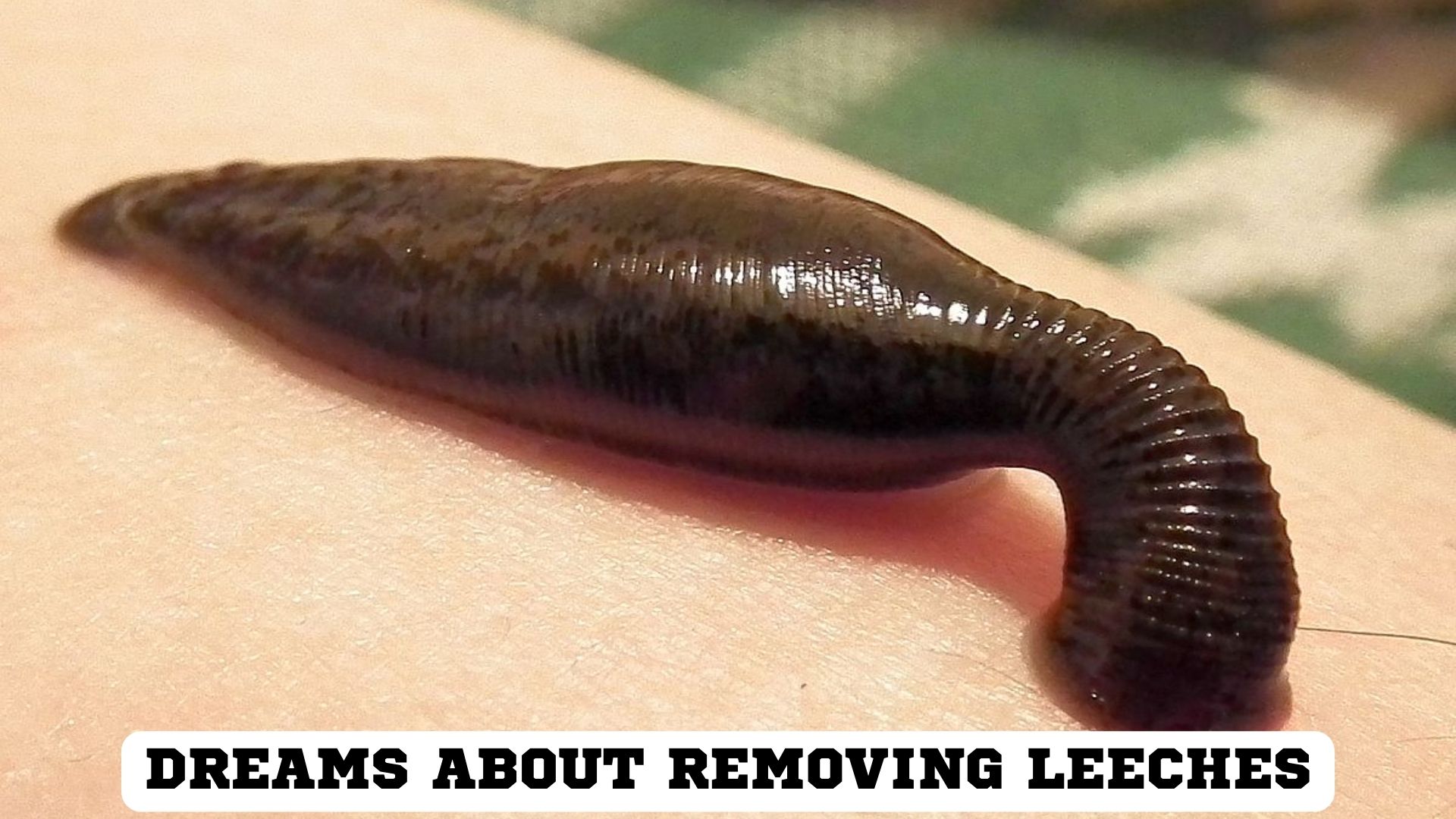 Dreams About Removing Leeches - A Signal For Weakness Or Subtlety