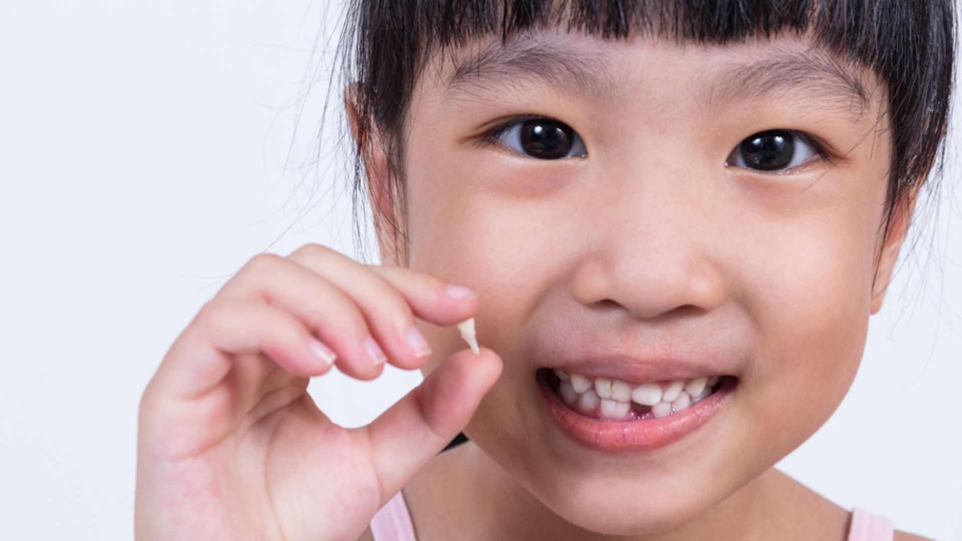 Asian Kid Showing Her Broken Teeth