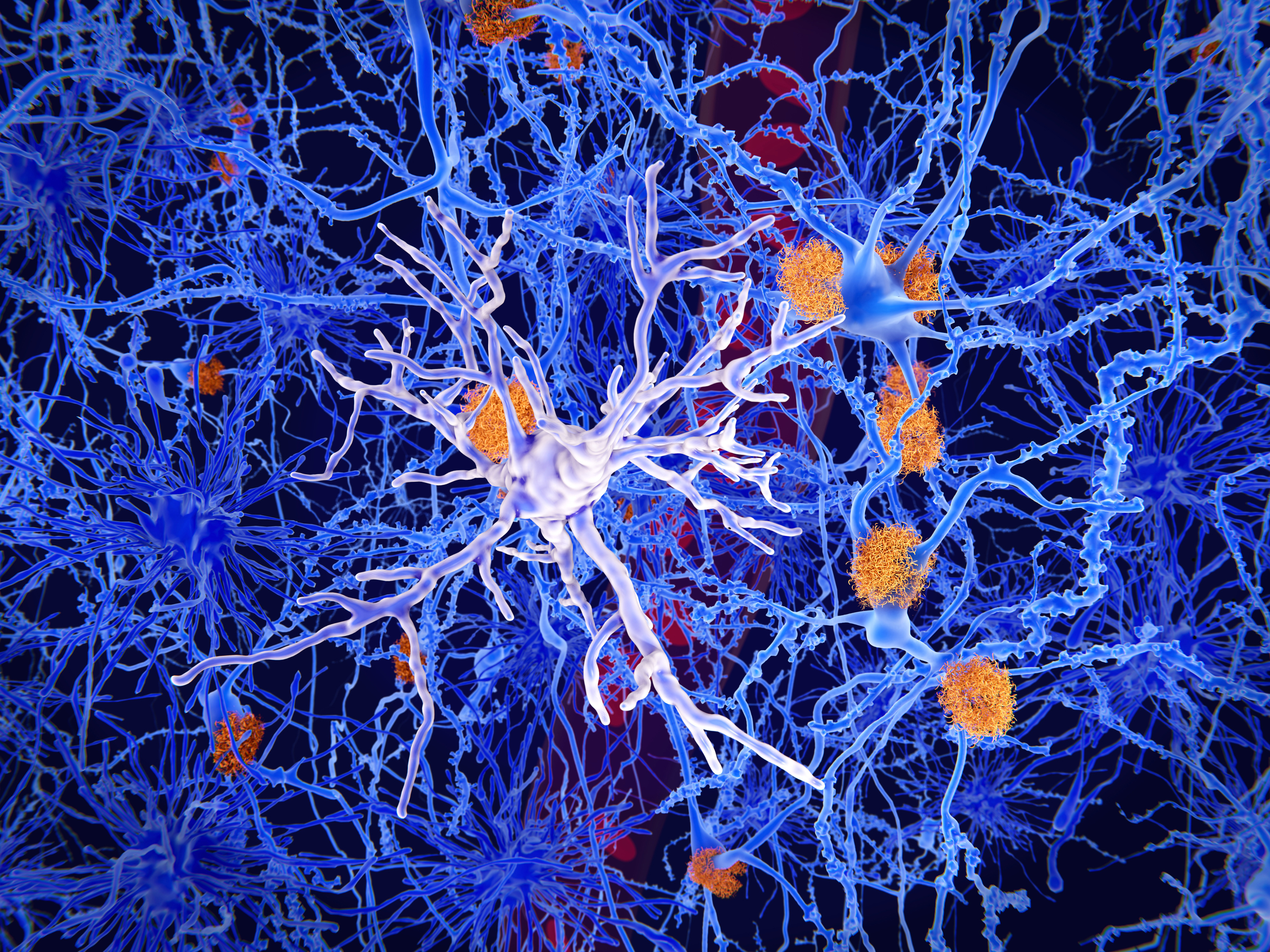 A blue colored picture showing the electric movements in the brain