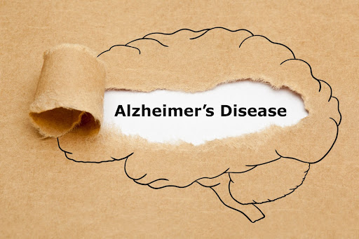 A brain drawn on a brown paper with the words Alzheimer's Disease written in a white background at the middle of the brain