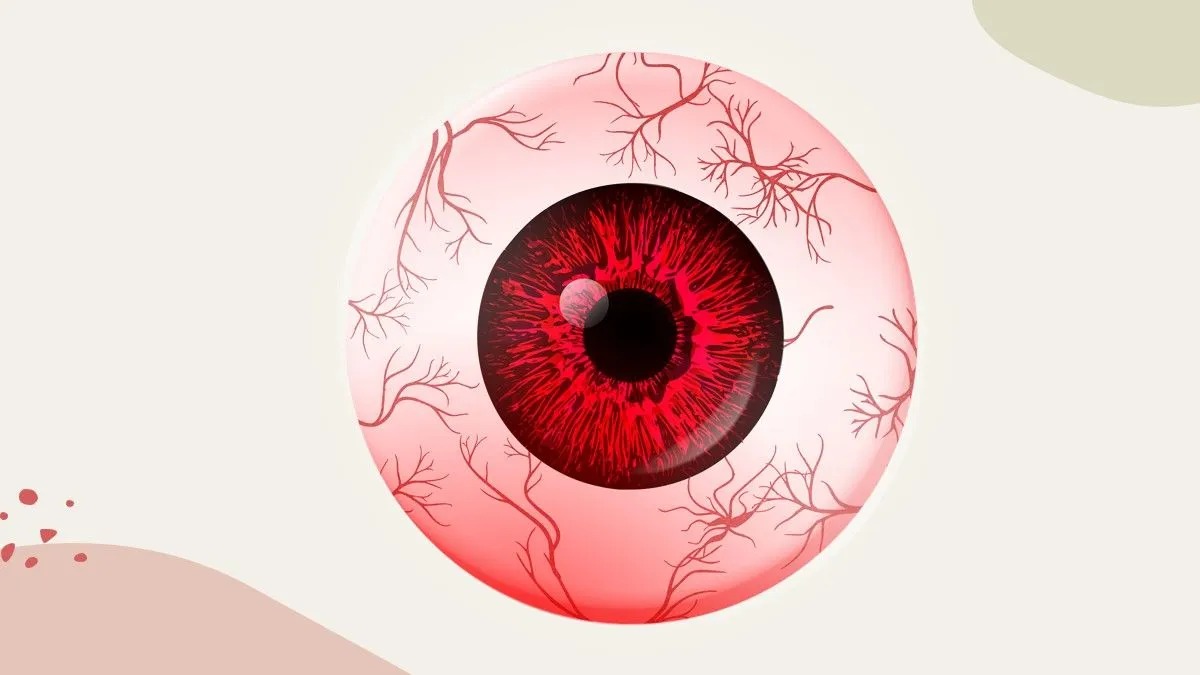 Illustration Of Red Eye