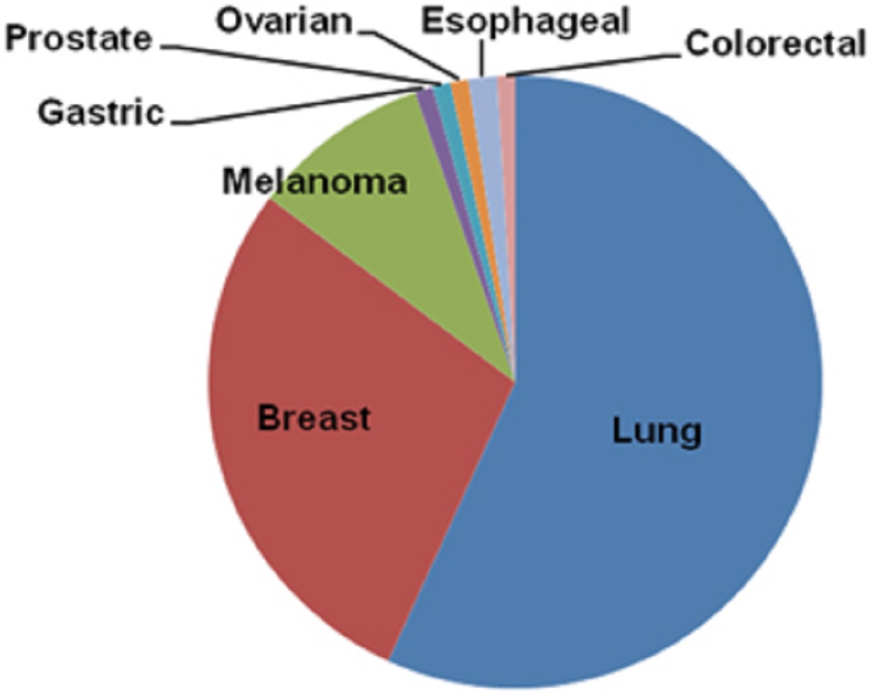A colored pie graph, with the word ‘lung’ in the biggest portion in color blue