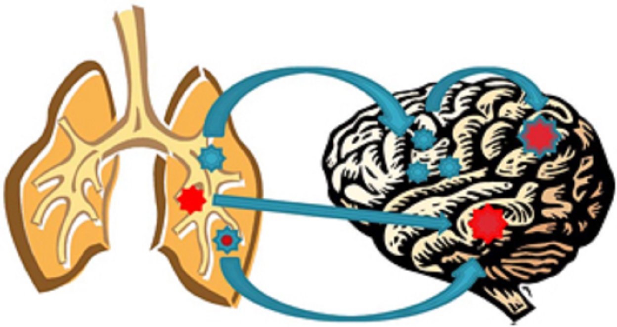 Drawing of a pair of lungs and brain, with four blue arrows pointing to blue and red spots in the brain
